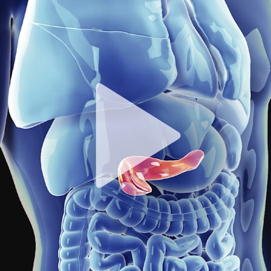 Servier symposium video